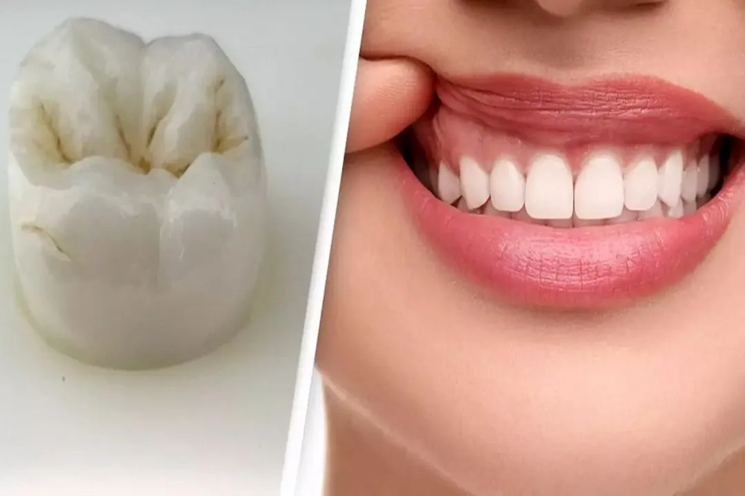 تکنولوژی های جدید برای رشد مجدد دندان 2 تکنولوژی های جدید برای رشد مجدد دندان