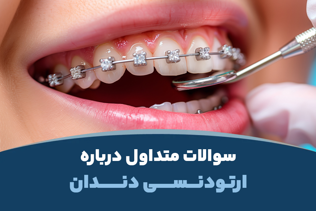 سوالات متداول درباره ارتودنسی دندان