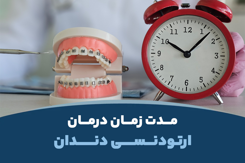 مدت زمان درمان ارتودنسی دندان چقدر است؟