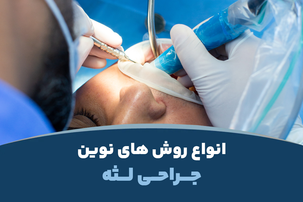 بررسی انواع روش های نوین جراحی لثه