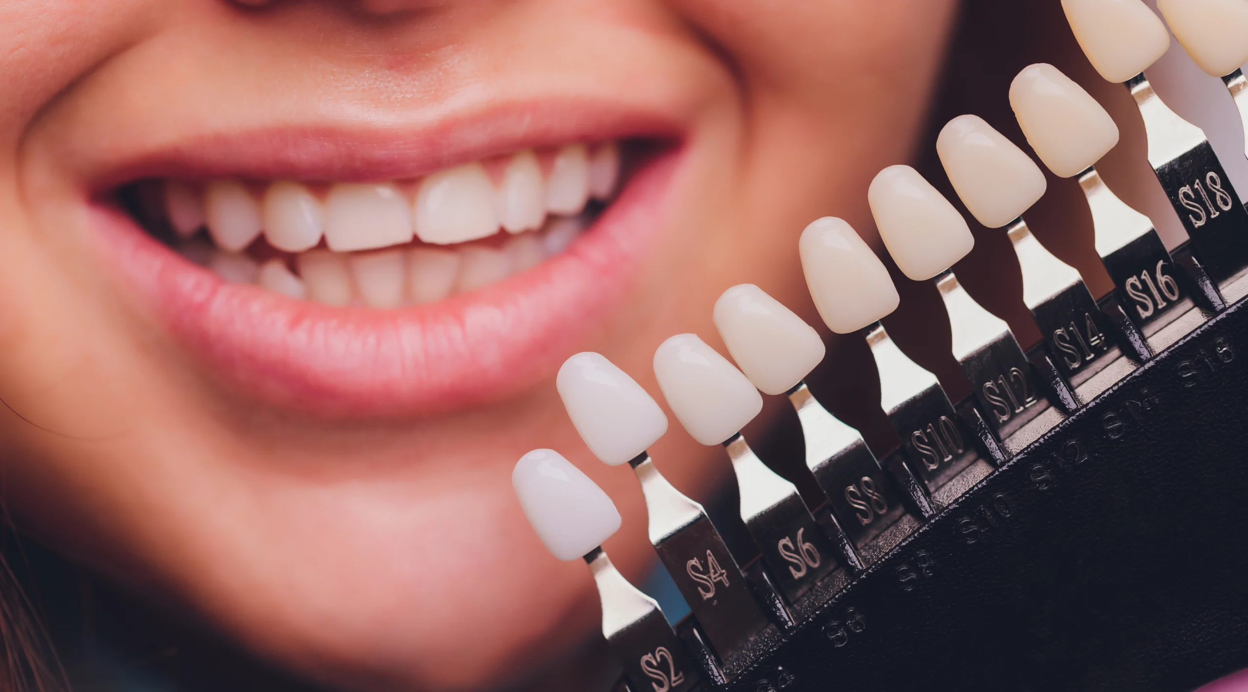 لمینت سرامیکی چگونه مشکلات بیخوابی را برطرف میکند؟ 1 لمینت سرامیکی چگونه مشکلات بیخوابی را برطرف میکند؟