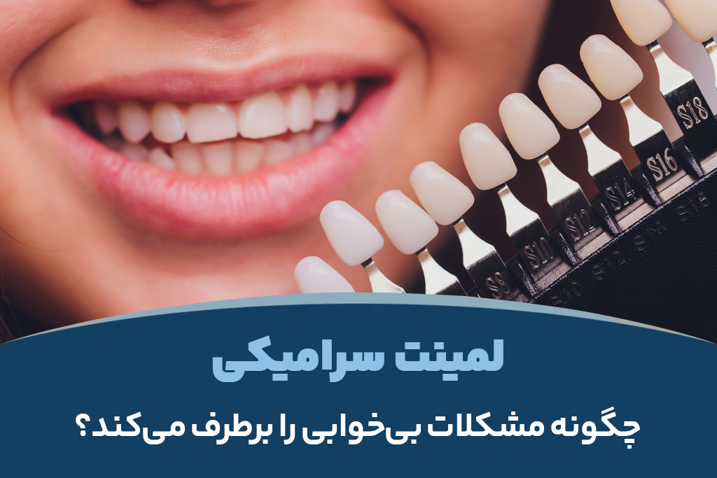 لمینت سرامیکی چگونه مشکلات بی‌خوابی را برطرف می‌کند؟