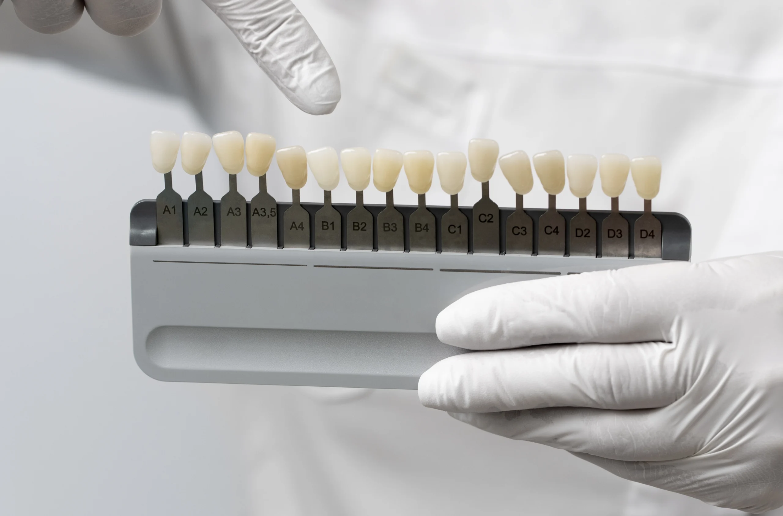 لمینت سرامیکی چگونه مشکلات بیخوابی را برطرف میکند؟ 2 لمینت سرامیکی چگونه مشکلات بیخوابی را برطرف میکند؟