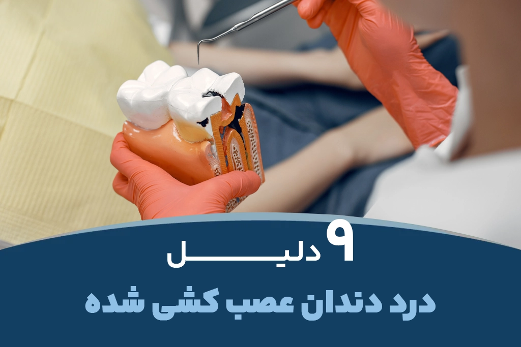 9 دلیل درد دندان عصب کشی شده