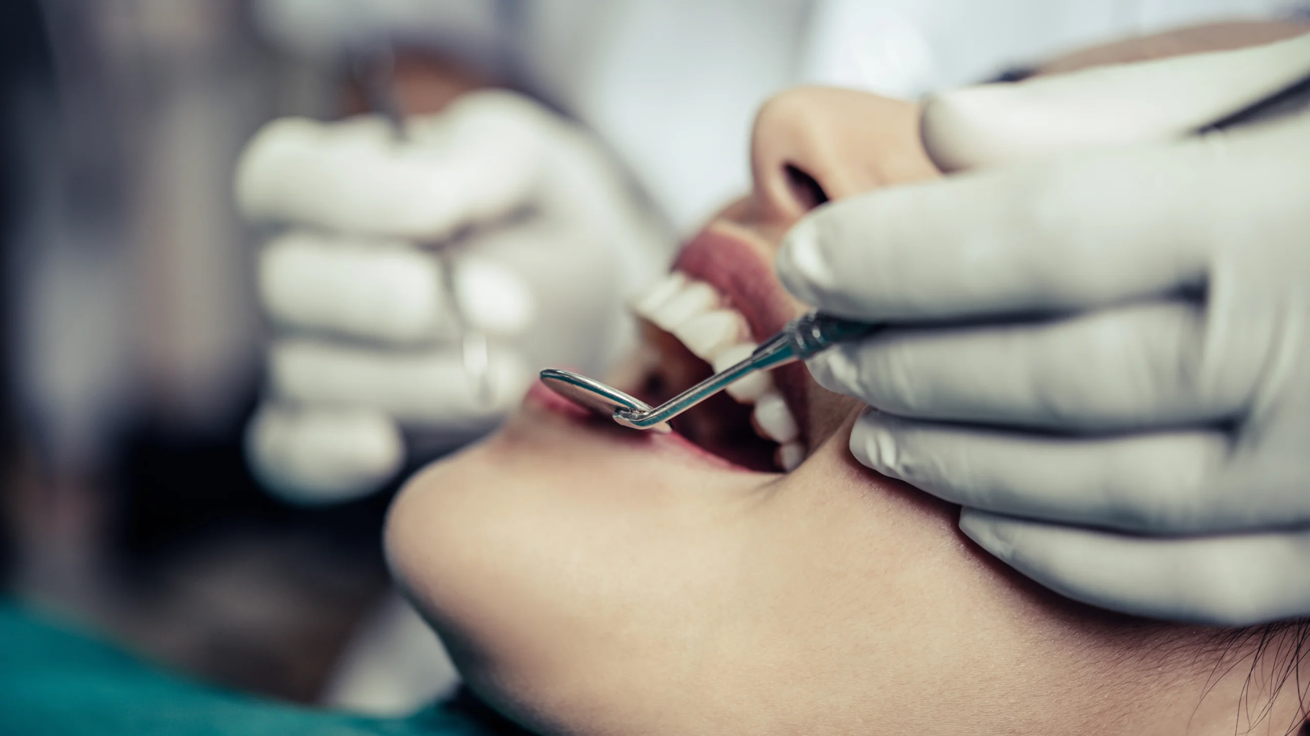 بررسی ایمپلنت پانچ؛ روشی کم‌تهاجمی و سریع برای کاشت دندان