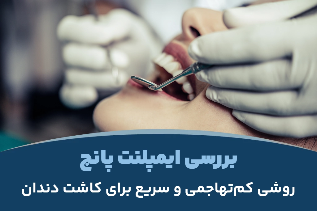 بررسی ایمپلنت پانچ؛ روشی کم‌تهاجمی و سریع برای کاشت دندان