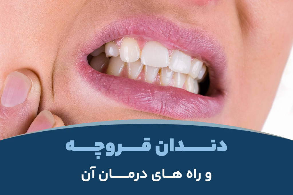 دندان قروچه و راه های درمان آن