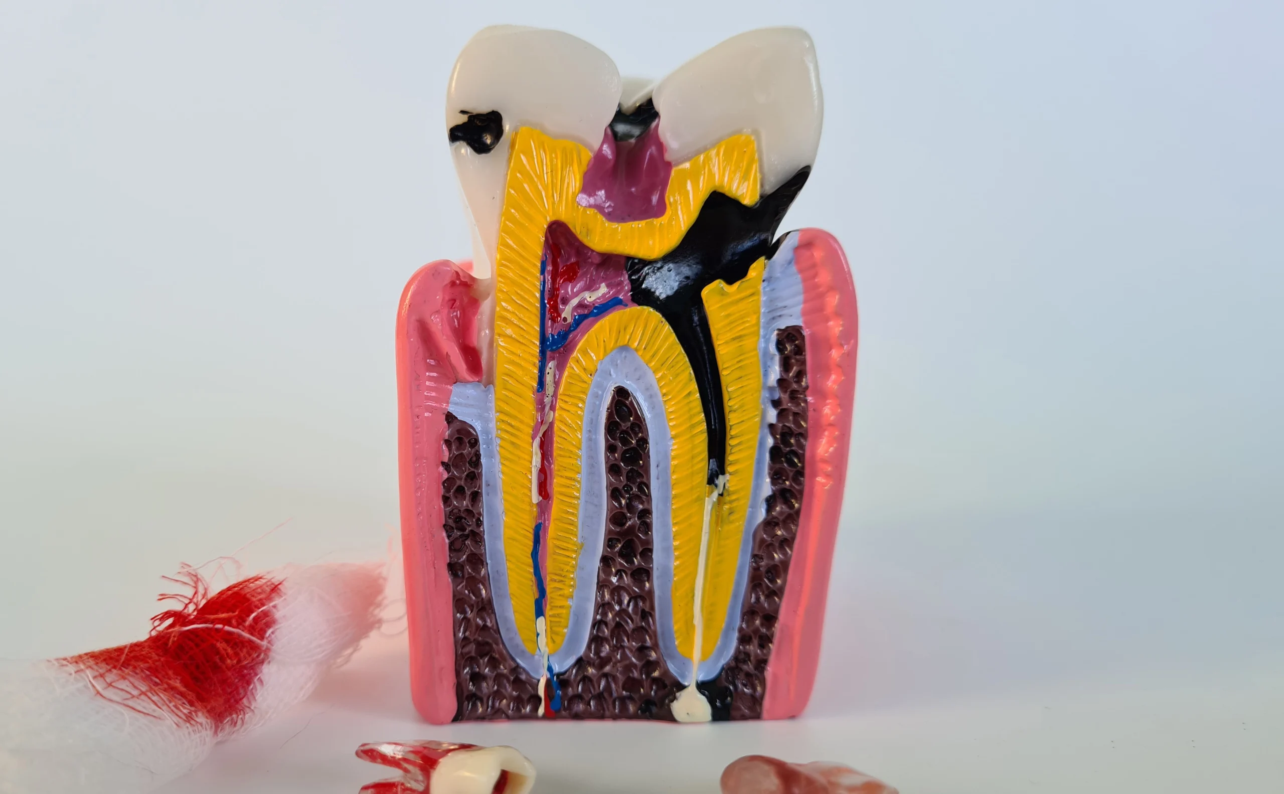 9 دلیل درد دندان عصب کشی شده