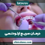 ارتودنسی سریع؛ آیا می توان مدت درمان ارتودنسی را کاهش داد؟