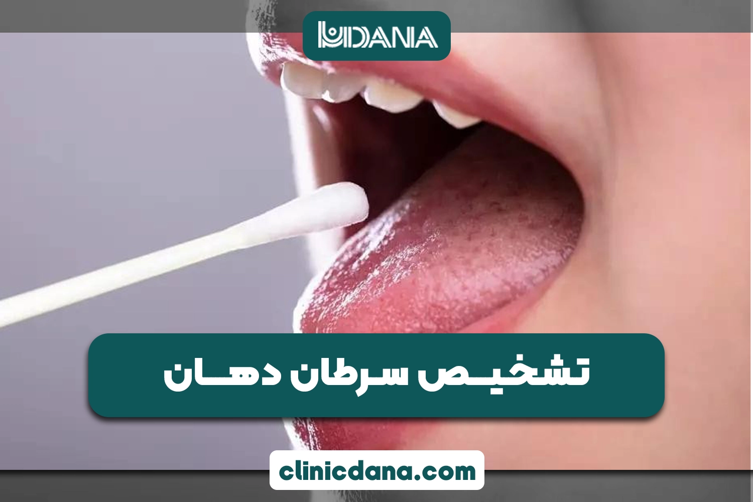 سرطان دهان را با آب دهان تشخیص دهید! مقایسه روش سنتی بیوپسی با تشخیص بزاقی جدید