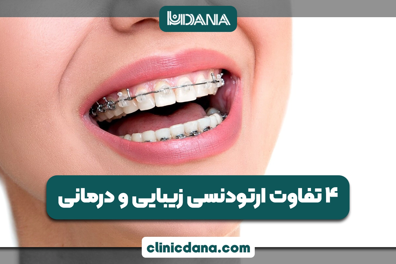 ارتودنسی درمانی؛ 4 تفاوت ارتودنسی زیبایی و درمانی