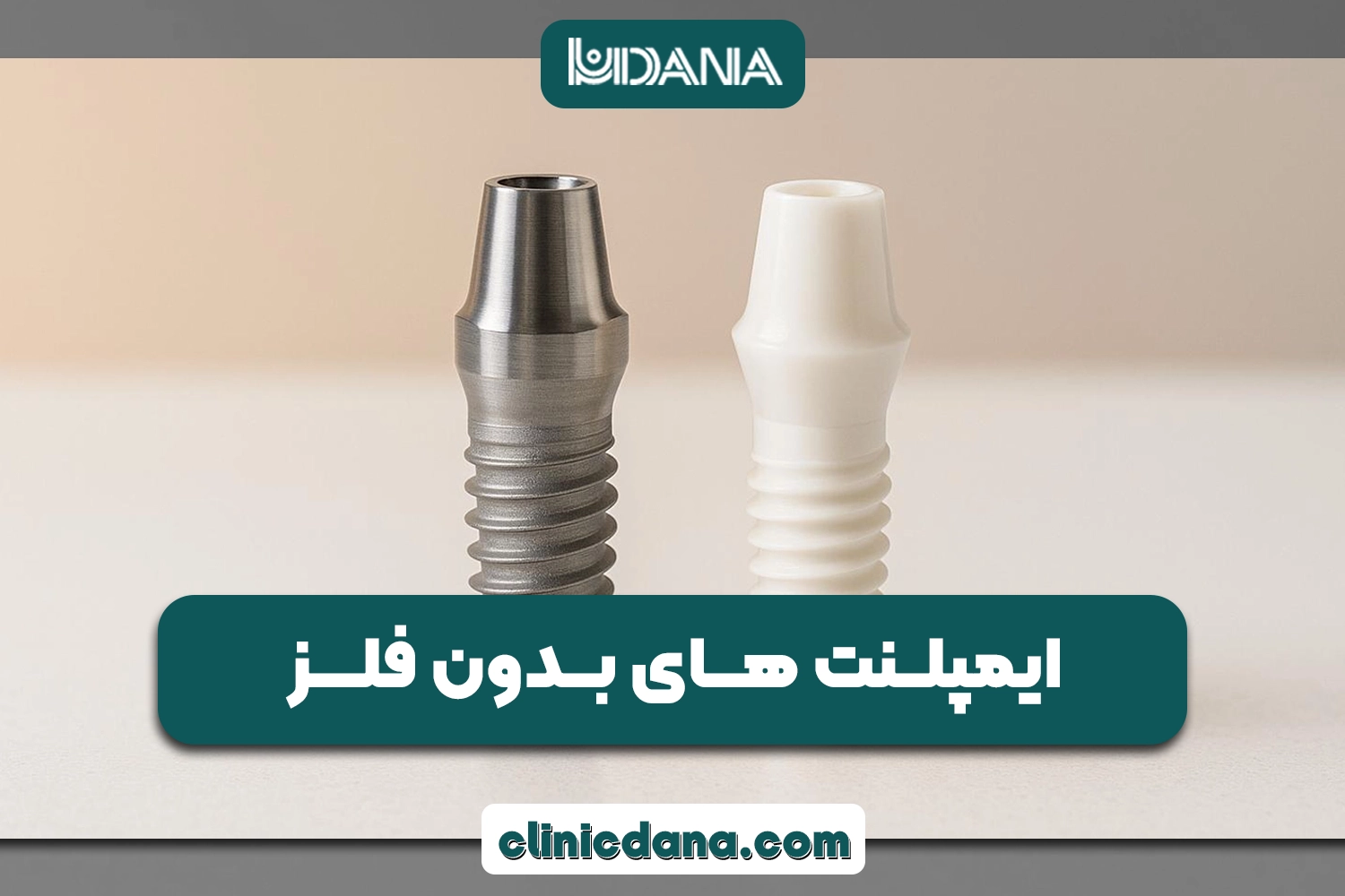 بررسی ایمپلنت های بدون فلز؛ جدیدترین روش کاشت دندان 2026
