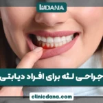 تاثیر دیابت بر دهان؛ آیا افراد دیابتی می توانند جراحی لثه انجام دهند؟
