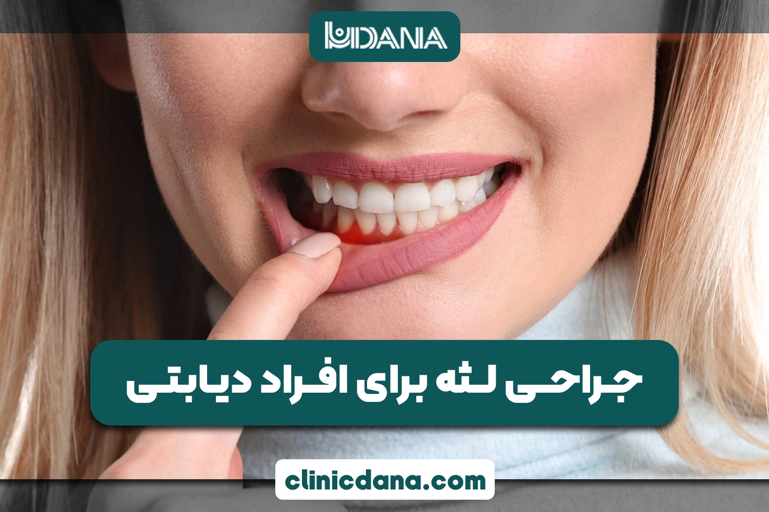 تاثیر دیابت بر سلامت دهان؛ آیا افراد دیابتی می توانند جراحی لثه انجام دهند؟