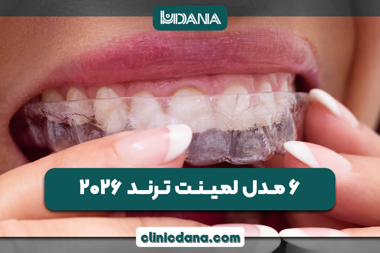 در سال 2026 چه مدل لمینتی ترند است؟ بررسی 6 مدل لمینت