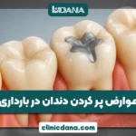 عوارض پر کردن دندان در بارداری؛ آیا در زمان حاملگی میتوان دندان پر کرد؟