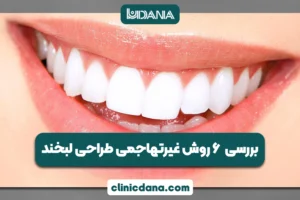 بزرگترین کلینیک چند تخصصی دندانپزشکی در شمال کشور 6 بررسی کامل 6 روش غیرتهاجمی طراحی لبخند