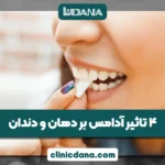 4 تاثیر آدامس بر دهان و دندان؛ چه زمانی جویدن آدامس به دندان آسیب می زند؟