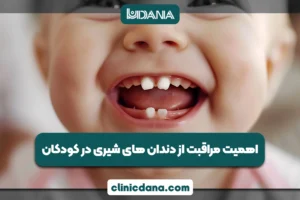 بزرگترین کلینیک چند تخصصی دندانپزشکی در شمال کشور 6 اهمیت مراقبت از دندان های شیری در کودکان