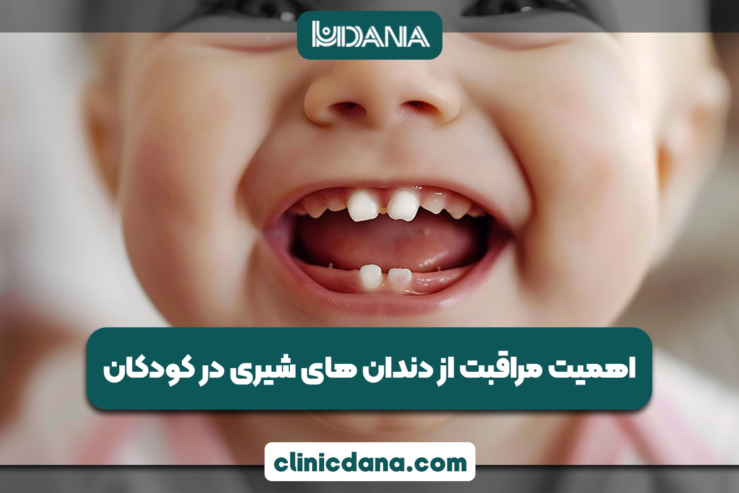 اهمیت مراقبت از دندان های شیری در کودکان