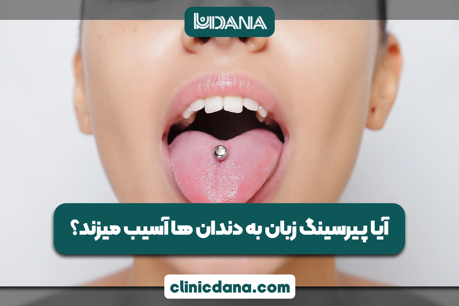 بررسی پیرسینگ دهانی؛ آیا پیرسینگ زبان به دندان ها آسیب میزند؟