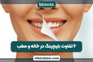 بزرگترین کلینیک چند تخصصی دندانپزشکی در شمال کشور 6 بلیچینگ در خانه بهتر است یا مطب؟ 6 تفاوت بلیچینگ در خانه و مطب