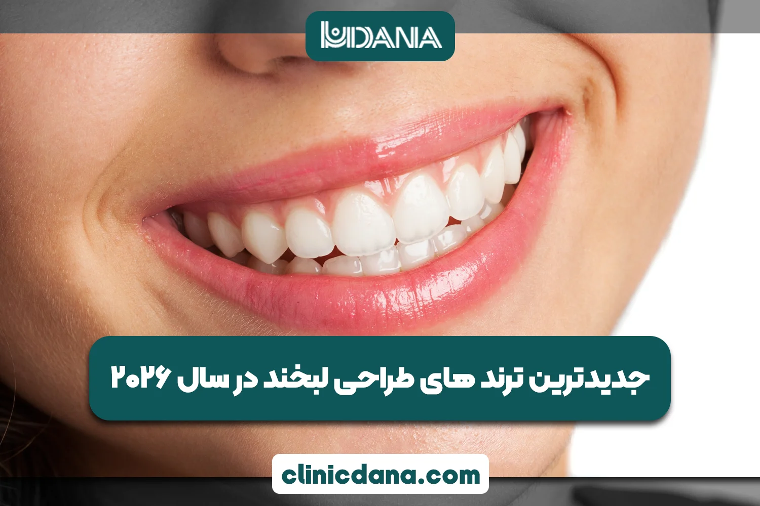 جدیدترین ترند های طراحی لبخند در سال 2026
