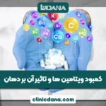 کمبود ویتامین ها و تاثیر آن بر دهان؛ چه ارتباطی بین ویتامین ها و دهان وجود دارد؟