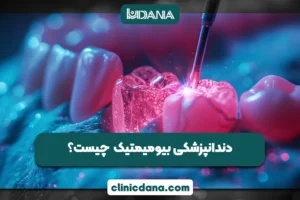 بزرگترین کلینیک چند تخصصی دندانپزشکی در شمال کشور 6 دندانپزشکی بیومیمتیک Biomimetic Dentistry چیست؟ 5 مزیت مهم، هزینه درمان و تفاوت با روکش دندان