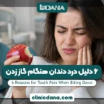 6 دلیل درد دندان هنگام گاز زدن؛ علت درد دندان هنگام گاز زدن چیست و چگونه درمان می شود؟