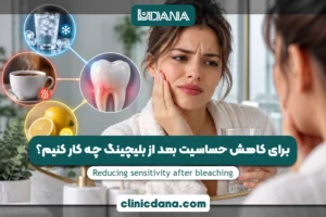 بزرگترین کلینیک چند تخصصی دندانپزشکی در شمال کشور 6 برای کاهش حساسیت بعد از بلیچینگ چه کار کنیم؟