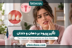 بزرگترین کلینیک چند تخصصی دندانپزشکی در شمال کشور 6 تأثیر پریود بر دهان و دندان؛ چرا لثه ها در دوران قاعدگی حساس و ملتهب می شوند؟