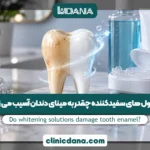 محلول های سفیدکننده چقدر به مینای دندان آسیب می زنند؟ ترندترین محصولات سفیدکننده دندان