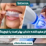 نوار سفیدکننده دندان بهتر است یا بلیچینگ؟