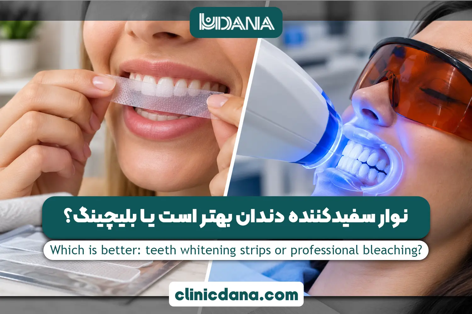 نوار سفیدکننده دندان بهتر است یا بلیچینگ؟